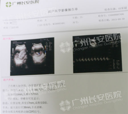【81376例报喜】越南新娘六年苦求孕 妙手仁医84天圆其梦