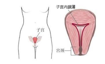 子宫内膜薄能怀孕么?