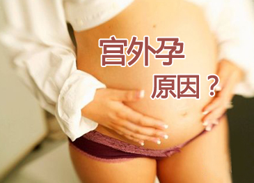 宫外孕有哪些原因