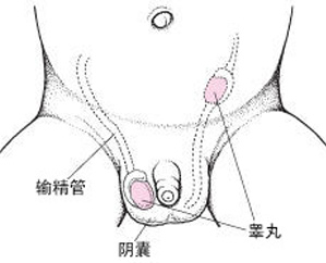 睾丸异常的症状