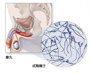 导致睾丸异常的原因主要